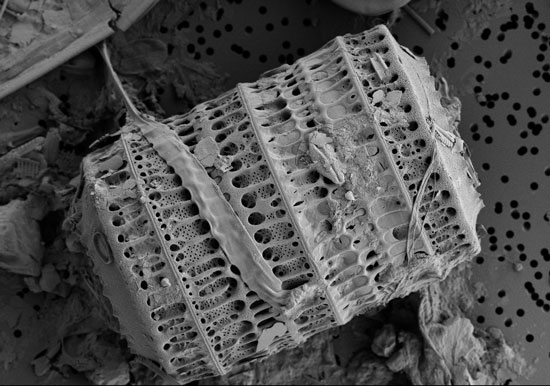 Diatom under Electron Scanning Microscope